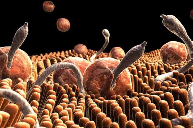 parazitët në trupin e njeriut