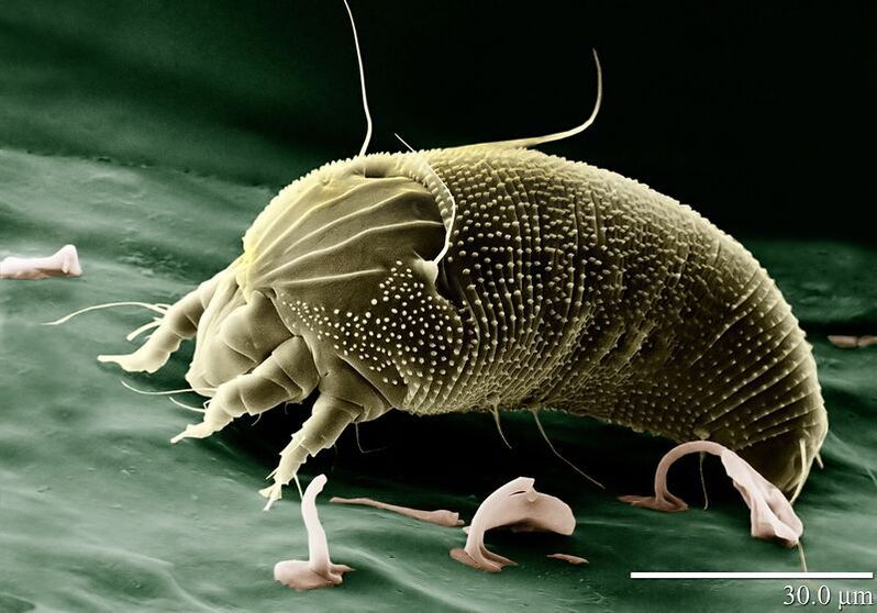 mite zgjebe